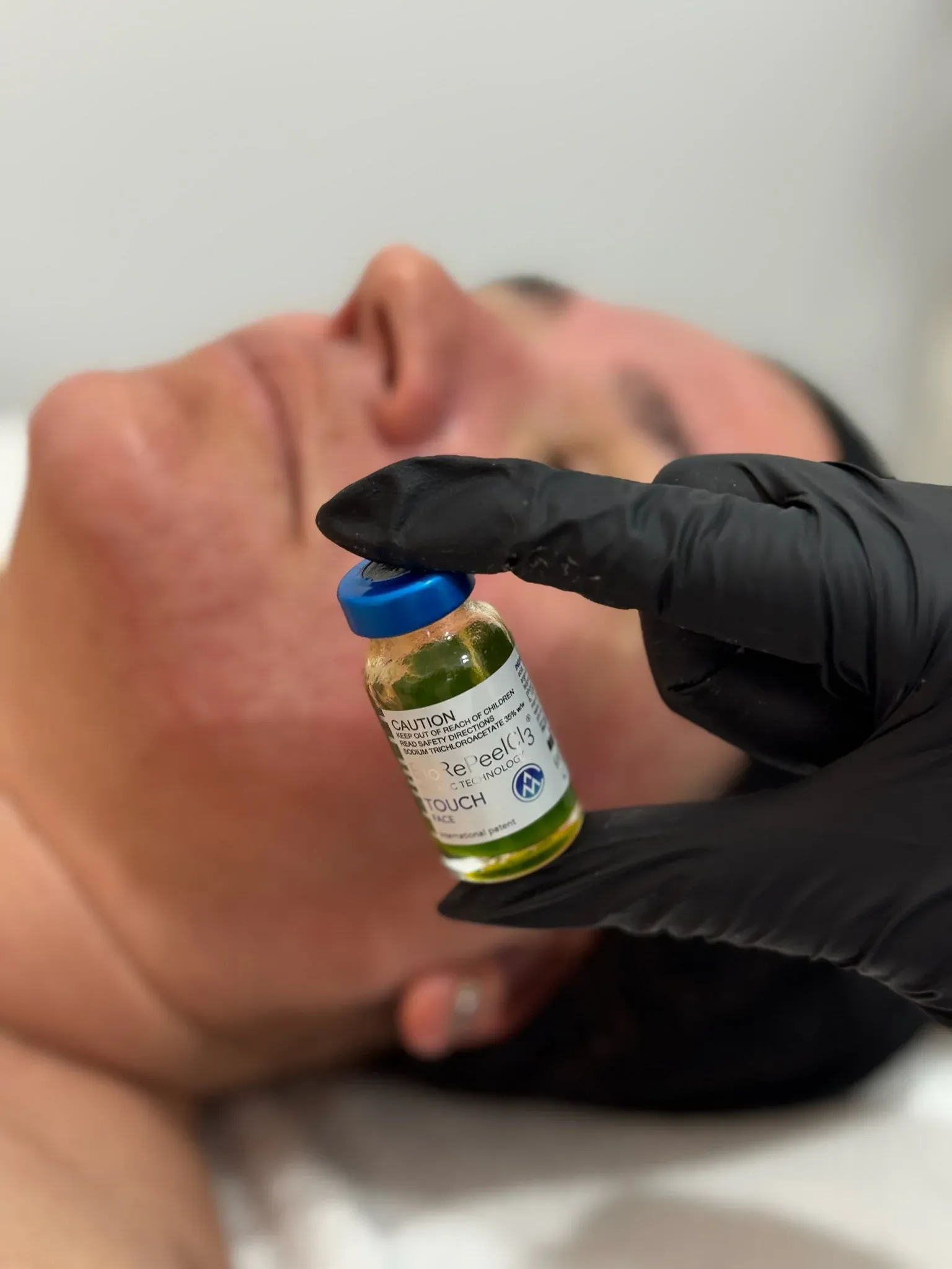 BIOREPEELCL3® Chemical Peel