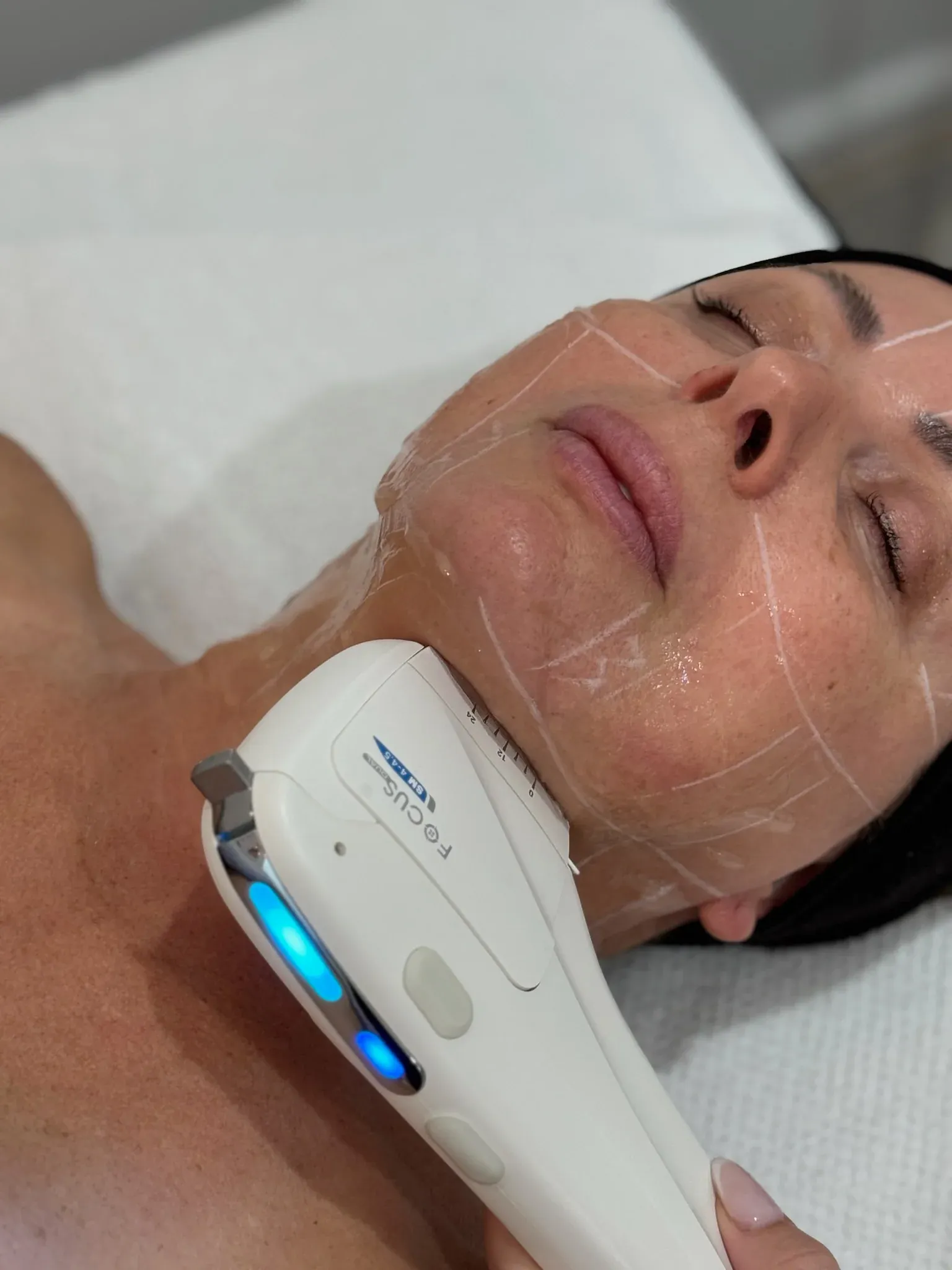 Focus Dual® HIFU Non-Surgical Facelift & Body Contouring