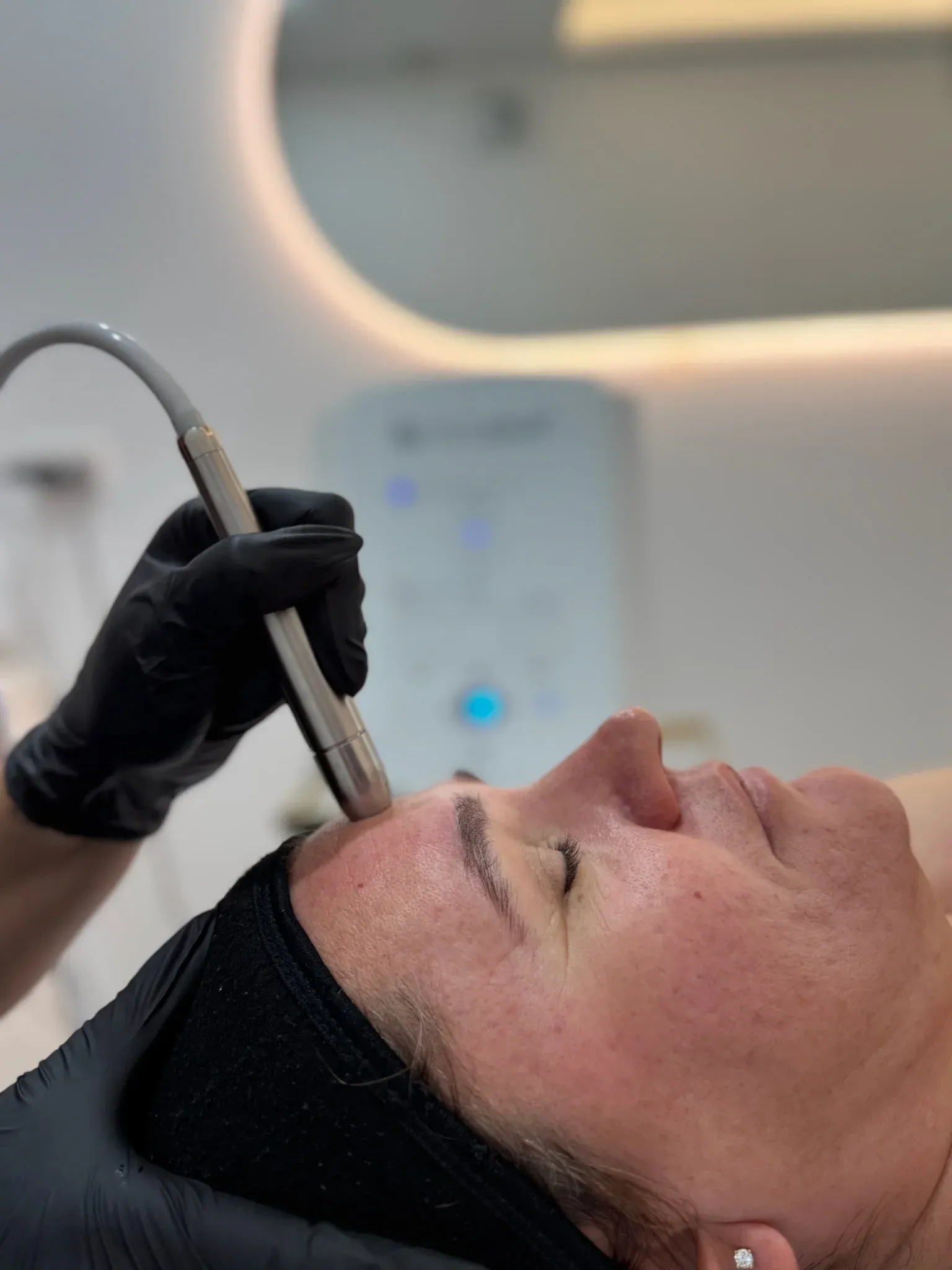 Microdermabrasion — precision treatment