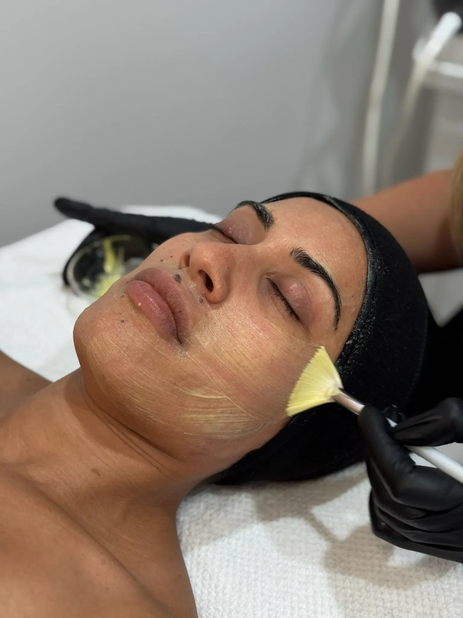 O Cosmedics® Pro Dermal Peels