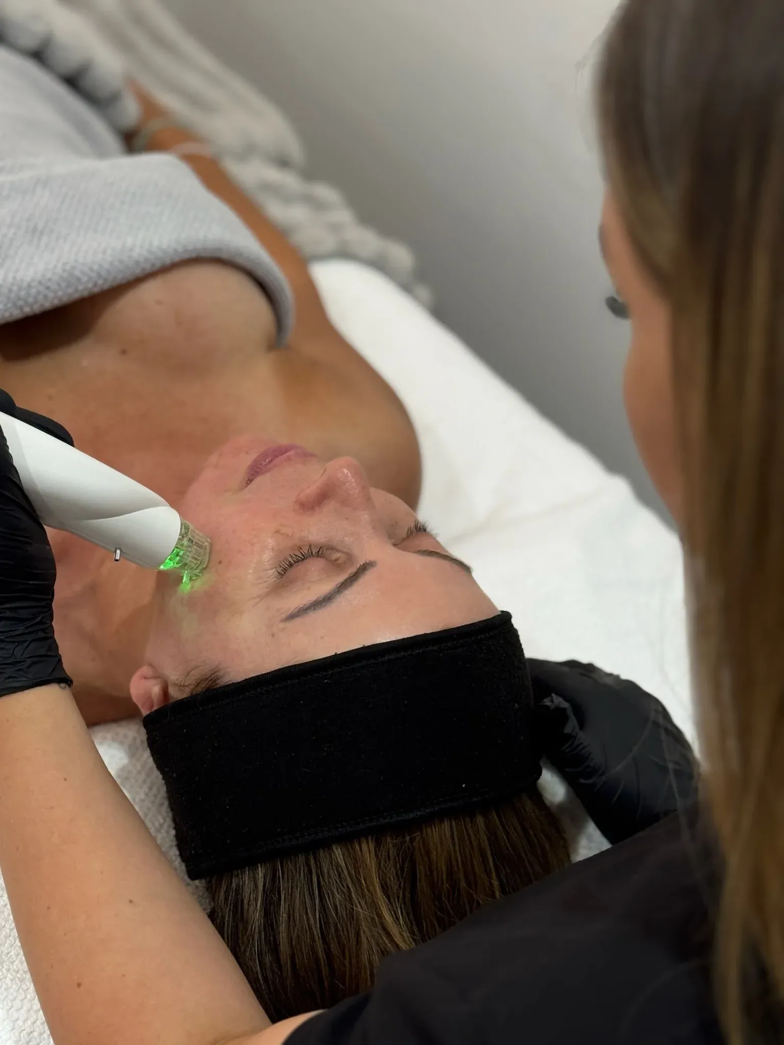 RF Microneedling