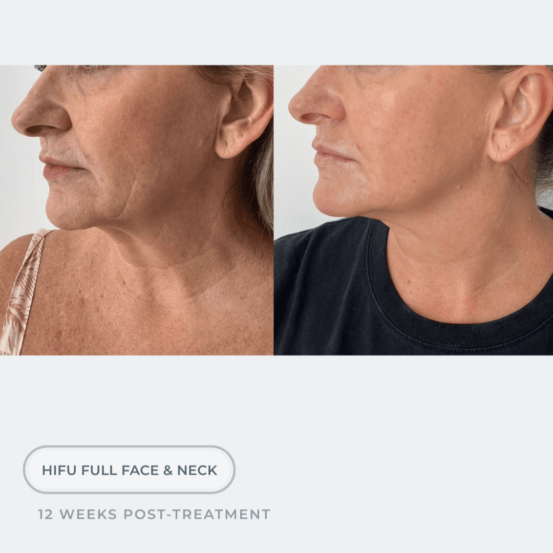Cosmo Medispa result