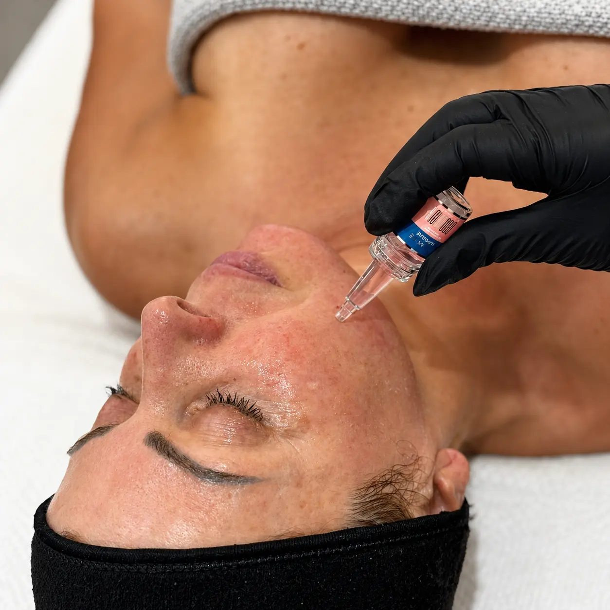 Cosmo Medispa result