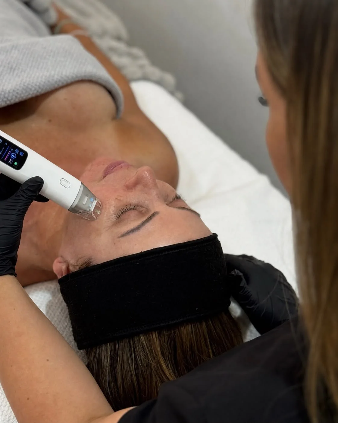 T33™ Ultra Cold Jet Plasma